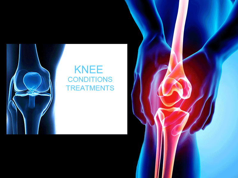 Mr Aslam Mohammed consultant knee surgeon provides a range of treatments for knee conditions - image painful knee 